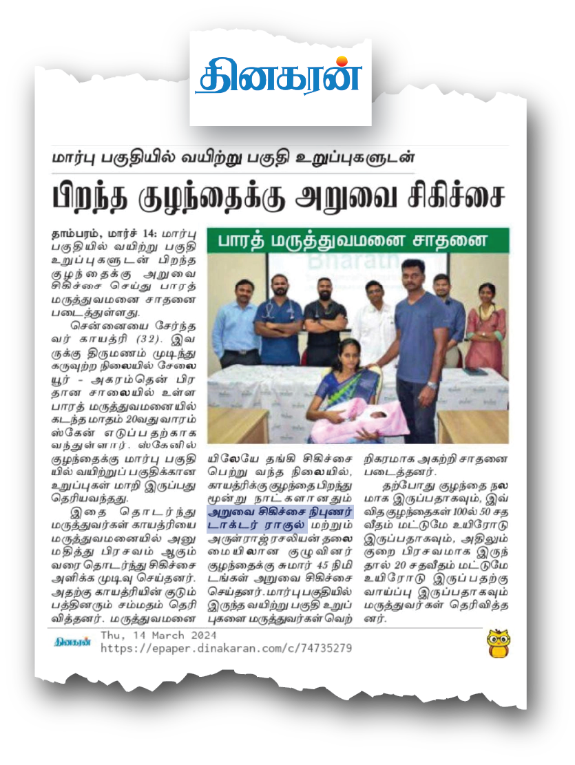 Dr. Raghul Maniam - Emergency Newborn CDH Repair in Dinakaran Tamil Daily Dr. Raghul Maniam neonatal surgeon news report in Dinakaran: Emergency Congenital Diaphragmatic Hernia CDH surgery in 3-day-old newborn at Bharath Hospital Chennai