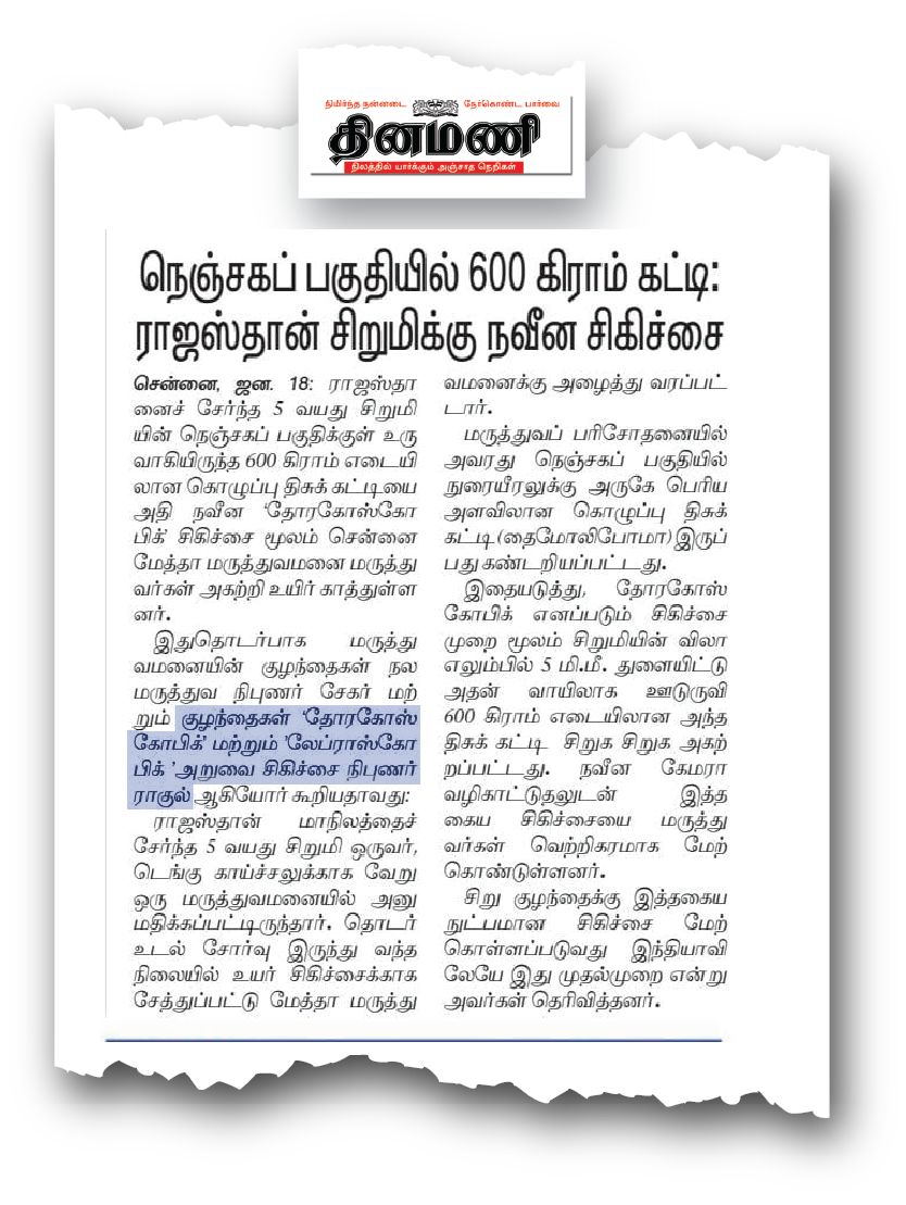 Dr. Raghul Maniam - 600g Chest Tumor Keyhole Surgery in Dinamani Dr. Raghul Maniam in Dinamani Tamil Daily: 5mm keyhole surgery removes 600g chest tumor in child at Dr. Mehta’s Hospital Chennai