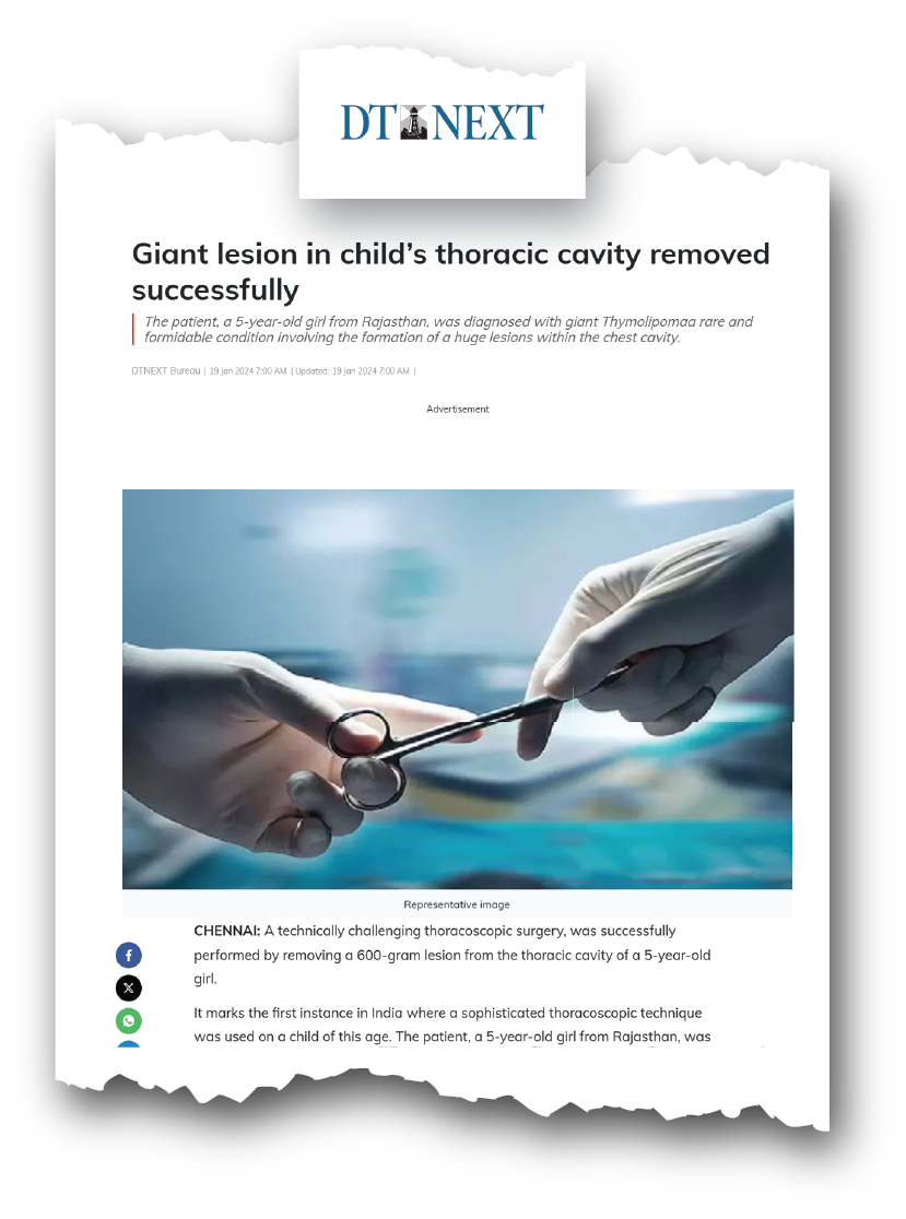 Dr. Raghul Maniam - 600g Giant Chest Lesion via 5mm VATS (DT Next) Dr. Raghul Maniam pediatric surgeon featured in DT Next news: 600g Giant Chest Lesion removed via 5mm VATS keyhole surgery at Dr. Mehta’s Children’s Hospital Chennai